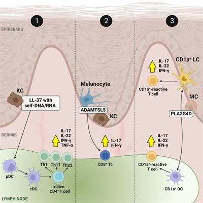 Molecular treatment trajectories within psoriatic T lymphocytes: a mini review